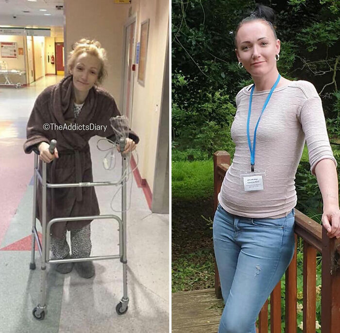 Before-and-after recovery images of a woman rebuilding her life using a walker and later standing outdoors confidently.
