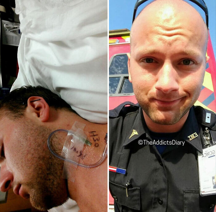 Before-and-after pics showing a man’s recovery and rebuilding his life from hospital bed to confident first responder.