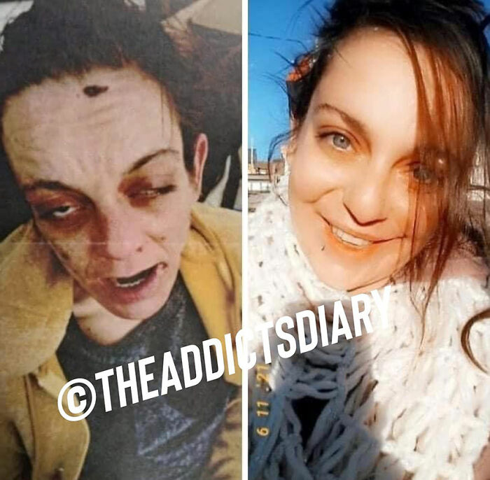 Before-and-after image showing a woman recovering and rebuilding her life with visible positive transformation.