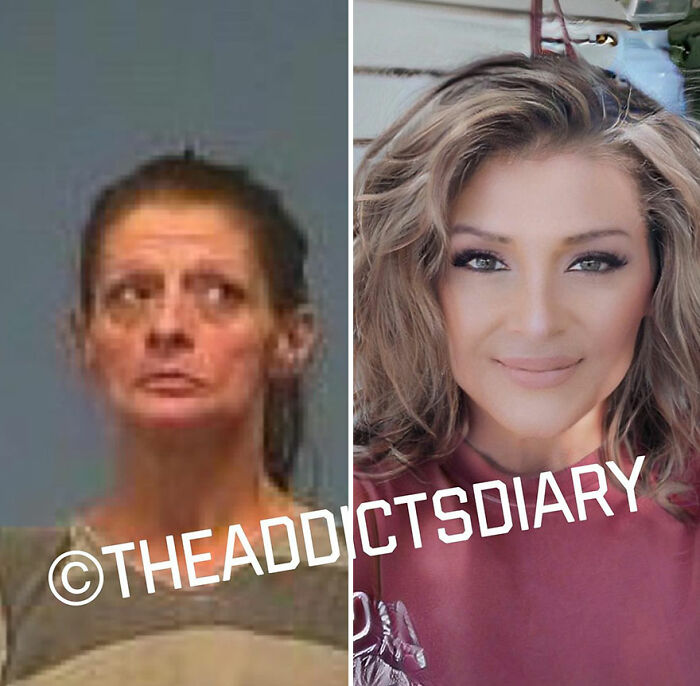 Before-and-after pics showing a woman's recovery and rebuilding her life with a refreshed and healthy appearance.