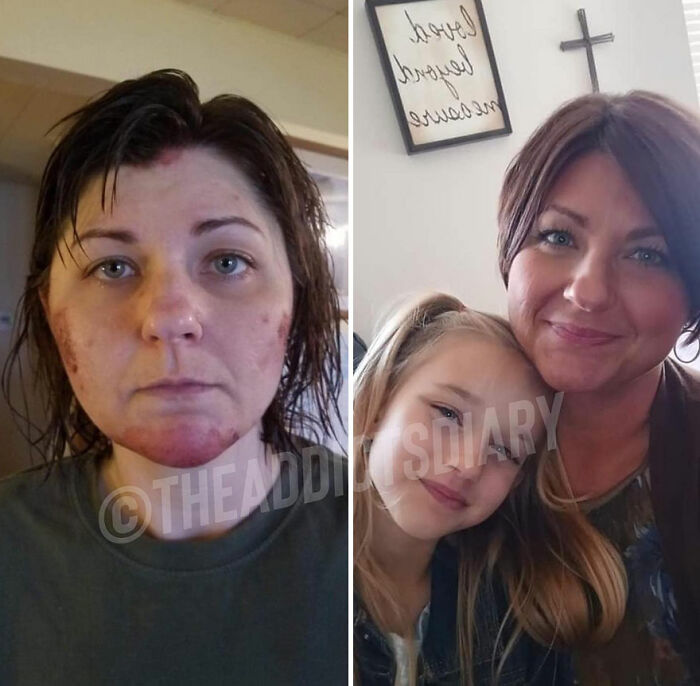 Woman showing before and after recovery transformation with improved skin and happy family moments rebuilding life.