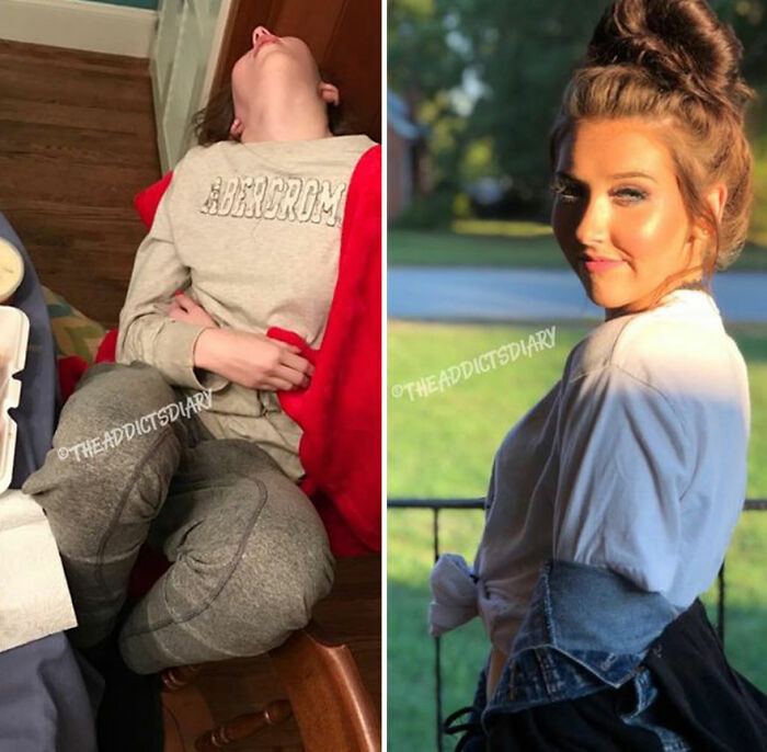 Before-and-after pics showing a person recovering and rebuilding their life, highlighting transformation and hope.