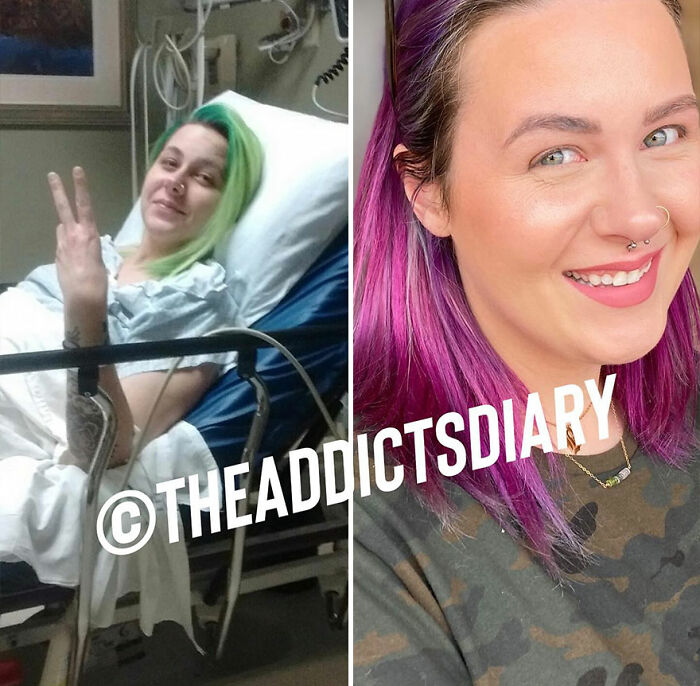 Side-by-side before and after photos of a woman recovering and rebuilding her life with vibrant hair and a bright smile.