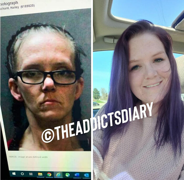 Before-and-after photos of a woman showing recovery and rebuilding her life with improved health and confidence.