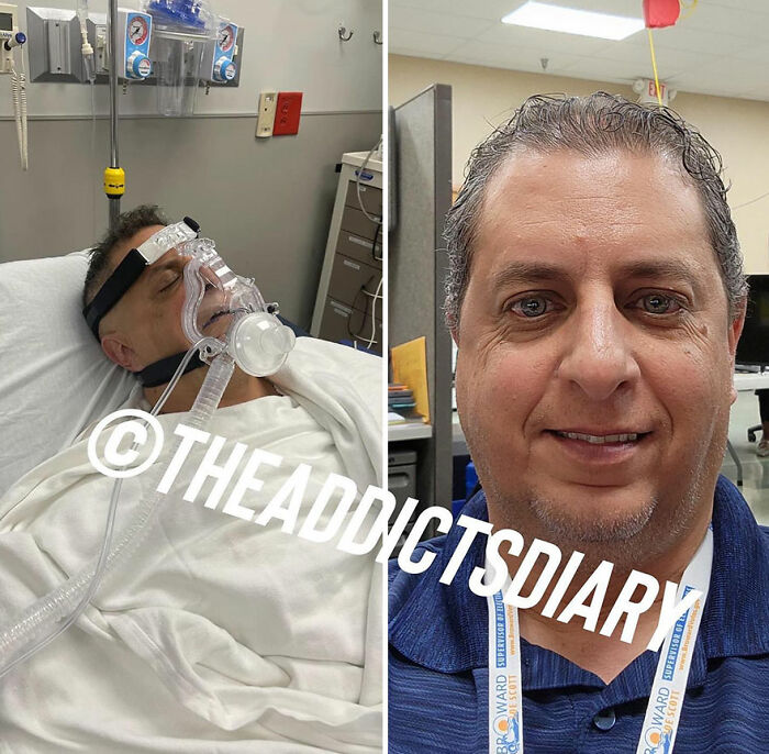 Side-by-side before-and-after pics showing a man recovering and rebuilding his life after a medical emergency.