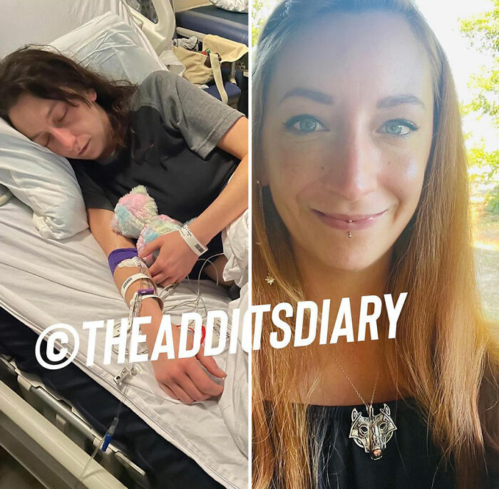 Side-by-side before-and-after photos showing a woman recovering and rebuilding her life after hospitalization.