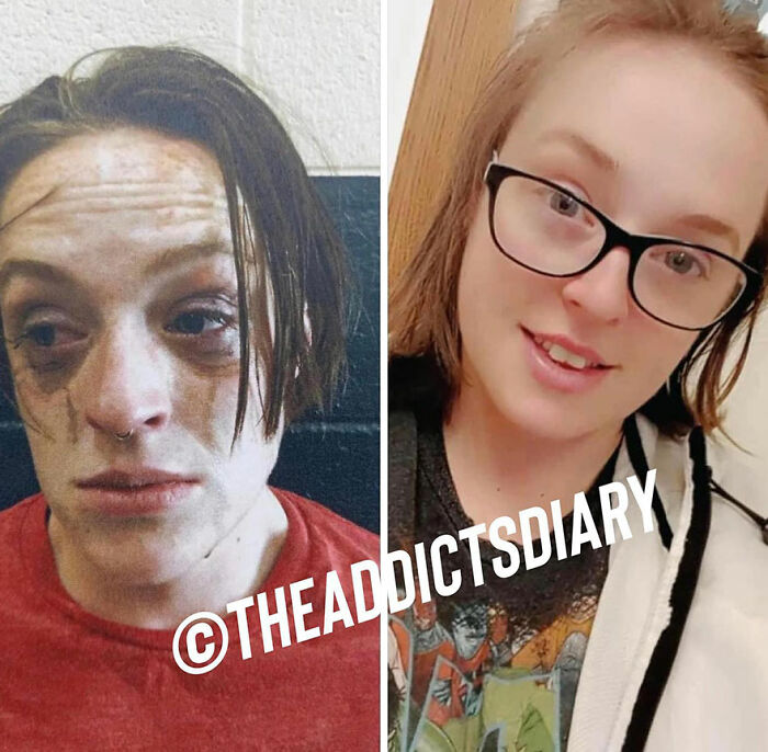 Before-and-after pics of a person showing recovery and rebuilding their life with a healthier and happier appearance.