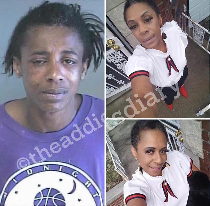 Before-and-after photos of a woman showing her dramatic recovery and rebuilding of her life with renewed confidence.