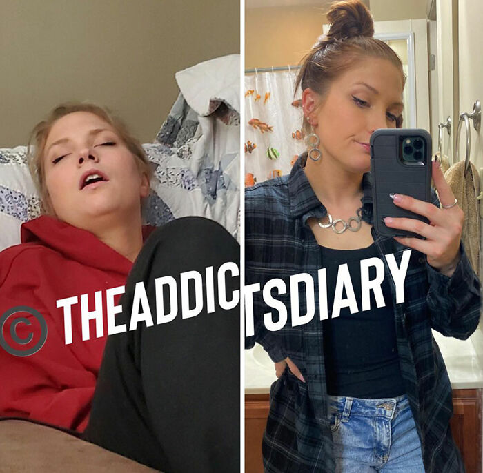 Before-and-after recovery photo of a young woman rebuilding her life, showing transformation and renewed health.