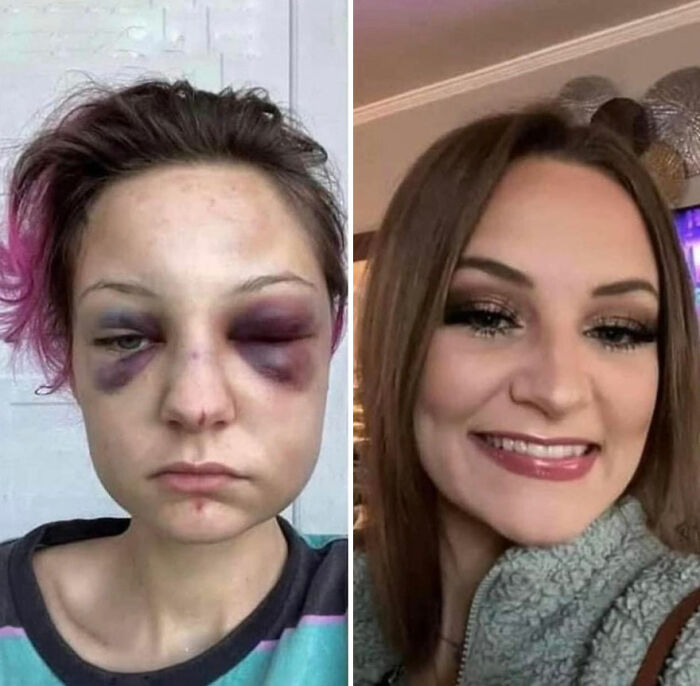 Before-and-after pics of a woman recovering and rebuilding her life, showing a dramatic transformation and healing.