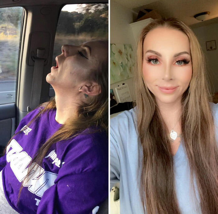 Side-by-side before and after photos showing recovery and rebuilding lives with improved health and appearance.