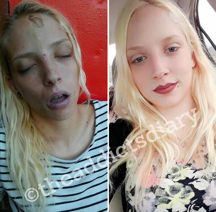Before-and-after pics showing a woman recovering and rebuilding her life with visible health and appearance improvements.