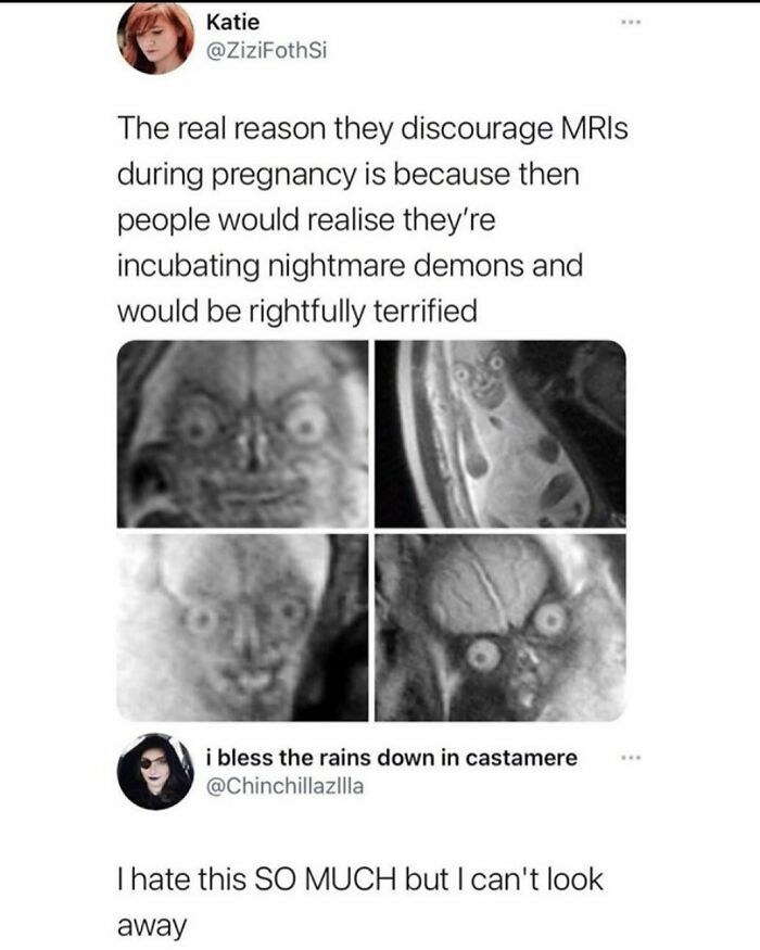 Funny and relatable medical memes showing eerie MRI scans humorously described as nightmare demons during pregnancy checkups.