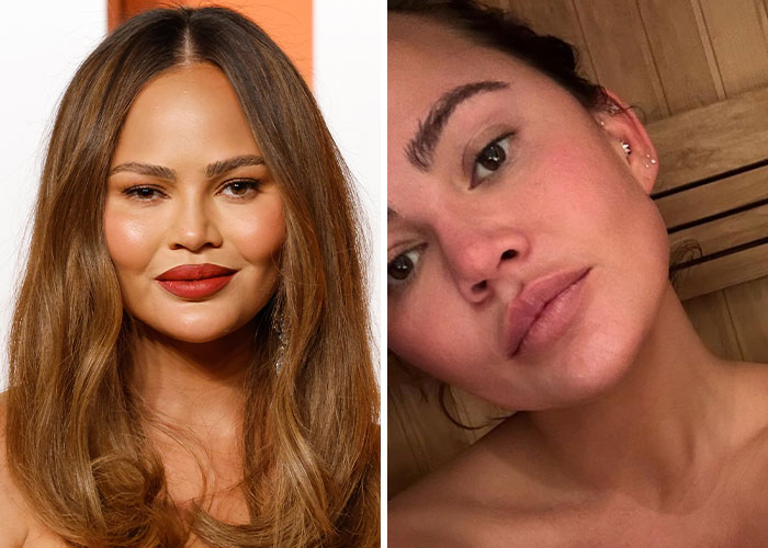 Side-by-side photos of a celebrity with makeup and without makeup, showing natural skin in casual lighting conditions.