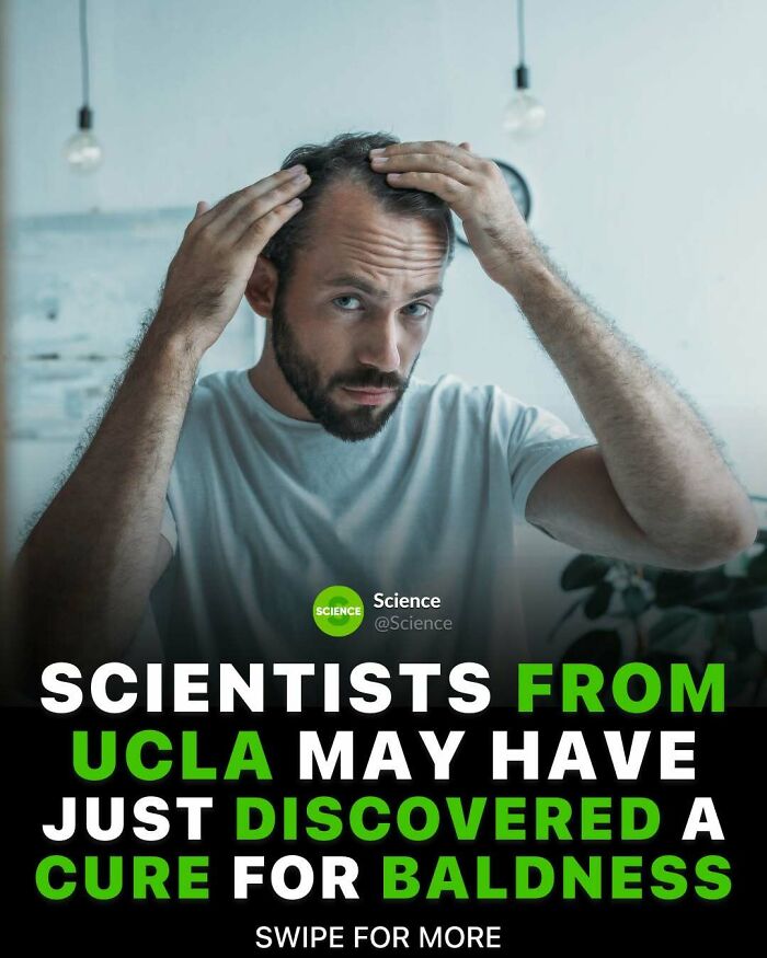 Man examining his hair for baldness while reading about scientific discoveries related to world and science facts.