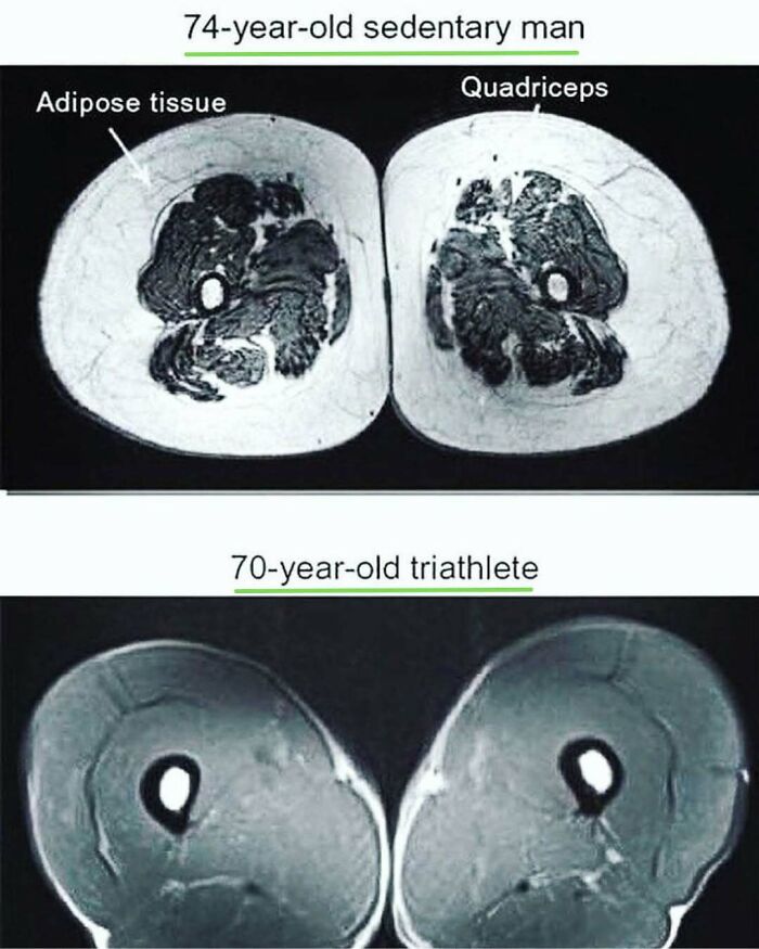 MRI scans showing muscle and fat tissue differences between a sedentary man and a triathlete, illustrating cool science facts.