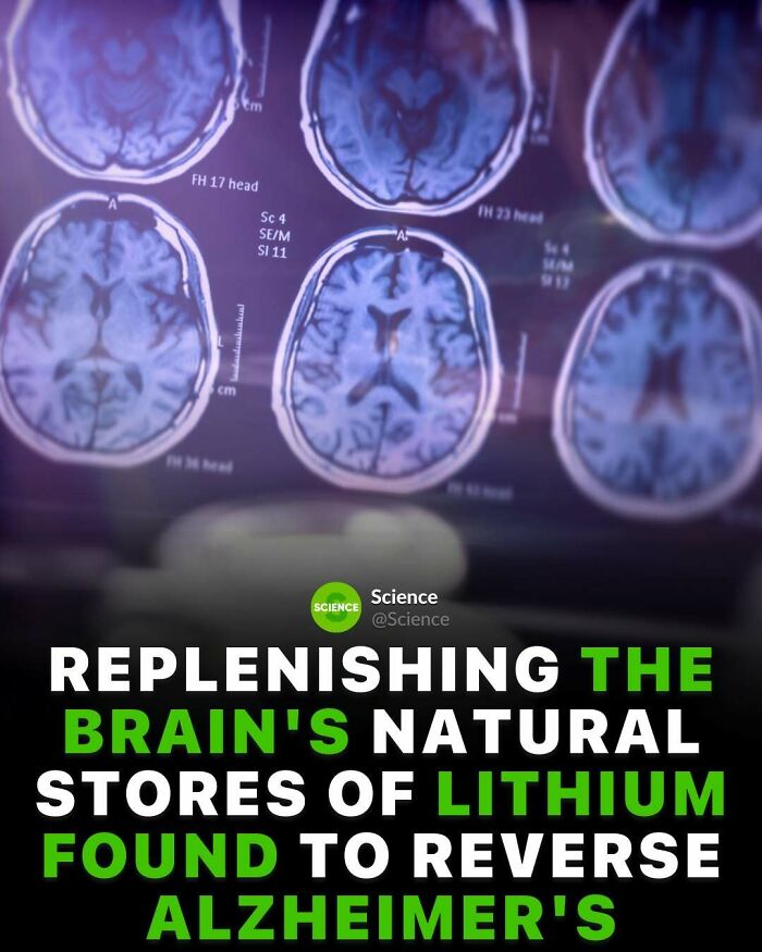 Brain MRI scans with text about replenishing the brain's natural stores of lithium to reverse Alzheimer's disease.