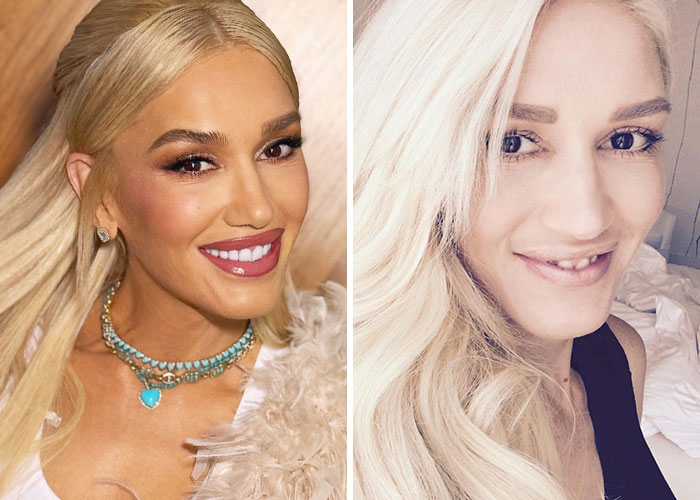 Side-by-side images of a star with makeup and professional lighting versus without makeup or professional lighting.