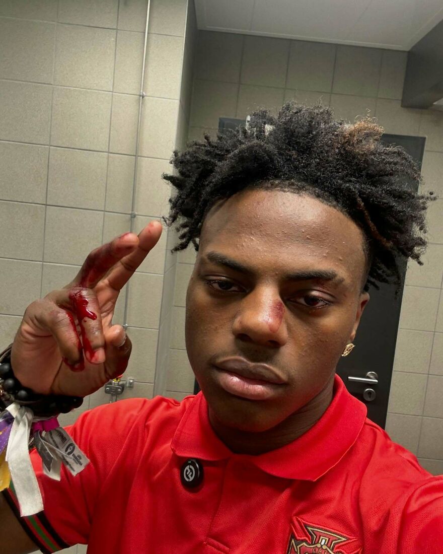 IshowSpeed Net Worth Grows From $0 To Millions In Just A Few Years