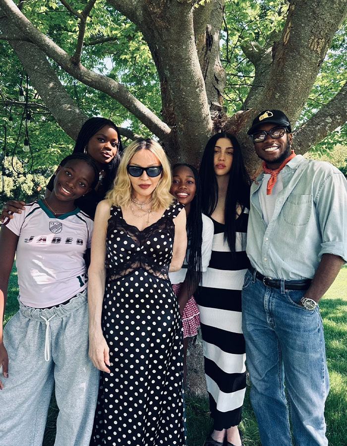 Madonna outdoors with friends under a tree, showcasing her style amid cosmetic change advice from her 29YO boyfriend.