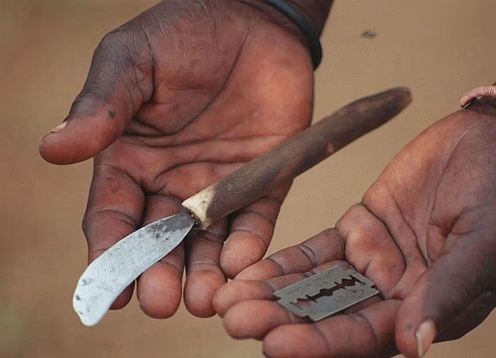 Close-up of hands holding a crude knife and razor blade used in a mass circumcision ceremony linked to deaths and mutilations. - 5