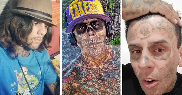 Brazilian Steve-O showing dramatic transformation after tattoo removal on his heavily tattooed face and body.
