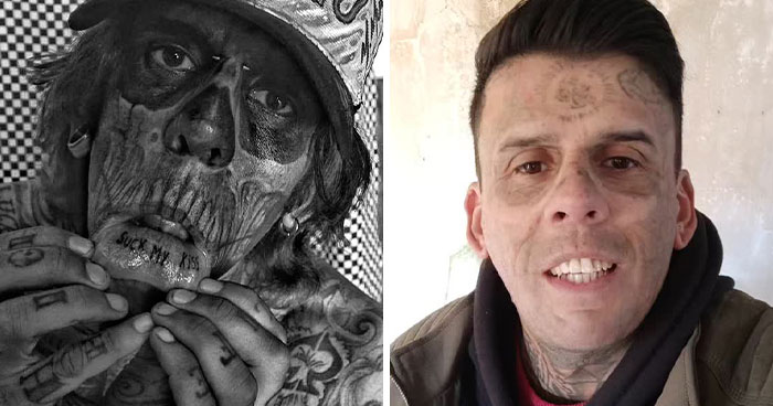Brazilian Steve-O before and after dramatic tattoo removal showing mostly clear skin and a new look.