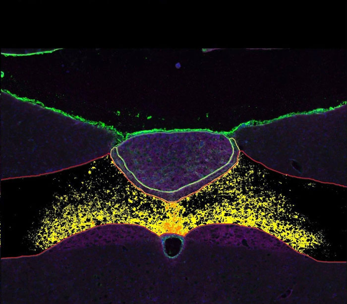 Microscopic image showing brain regions studied by scientists discovering Ozempic's healthier rival with no nausea or side effects.