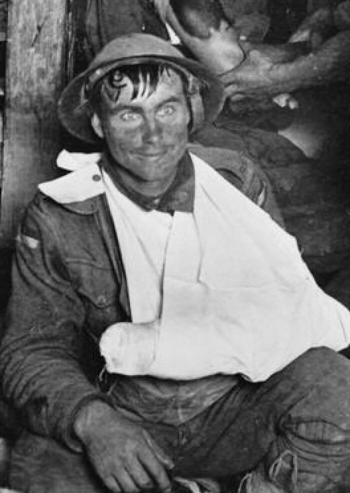 Black and white photo of a soldier with a bandaged arm, captured in a creepy and unsettling moment during war.