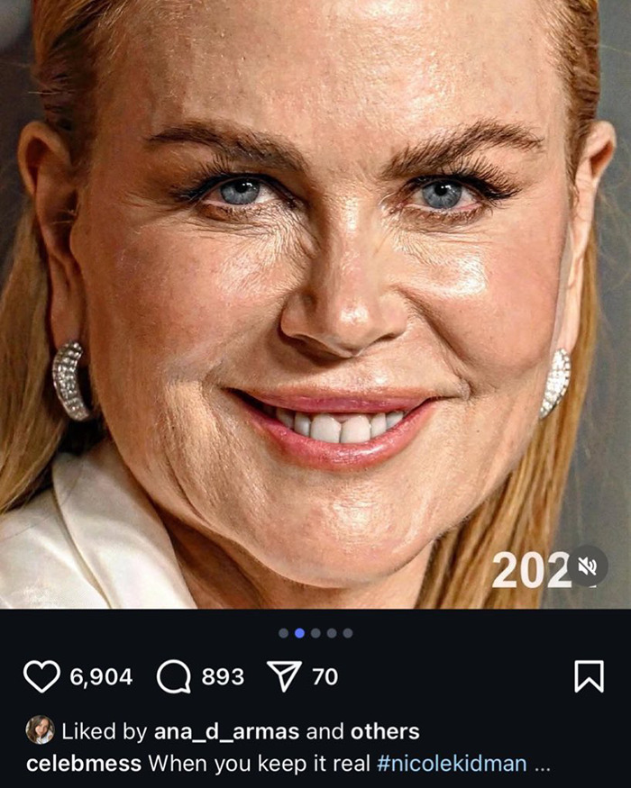 Close-up of Nicole Kidman with a smile, featured in a controversial post involving Ana de Armas mocking her looks. Close-up of Nicole Kidman with a smile, featured in a controversial post involving Ana de Armas mocking her looks.