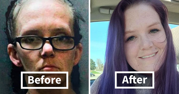 50 Before-And-After Pics And Inspiring Stories About Life-Changing Recoveries