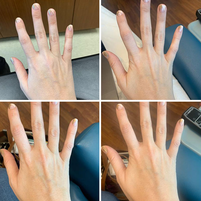 Four close-up images showing detailed comparisons of hands with natural nails in different lighting and angles.