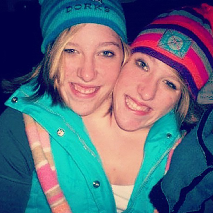 Conjoined Hensel twins smiling outdoors wearing winter hats and jackets, sparking discussion on motherhood and marriage. Conjoined Hensel twins smiling outdoors wearing winter hats and jackets, sparking discussion on motherhood and marriage.