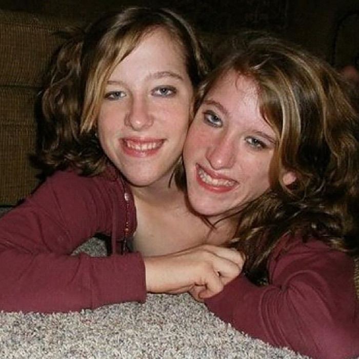 Conjoined Hensel twins smiling together indoors, sparking speculation about motherhood and marriage after new baby news. Conjoined Hensel twins smiling together indoors, sparking speculation about motherhood and marriage after new baby news.