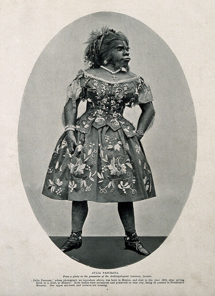 Historical photo of Julia Pastrana in an embroidered dress, showcasing a rare and wild moment from the past.