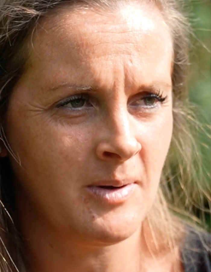 Close-up of a woman outdoors showing concern, reflecting years of dismissed pain before diagnosis of rare disorder. Close-up of a woman outdoors showing concern, reflecting years of dismissed pain before diagnosis of rare disorder.