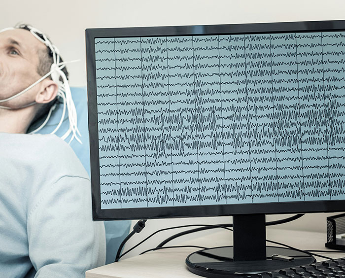 Man undergoing brain monitoring with EEG screen showing wave patterns related to medical mystery of no sleep for two years.