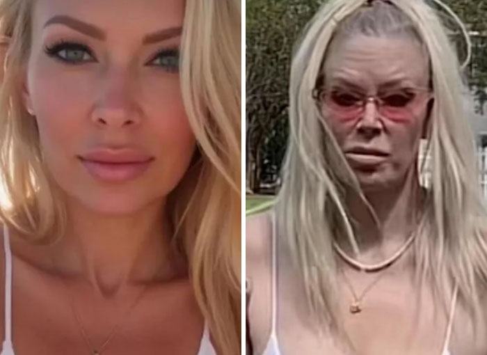 Side-by-side Instagram vs reality pics showing contrast between curated images and real-life appearance outdoors.