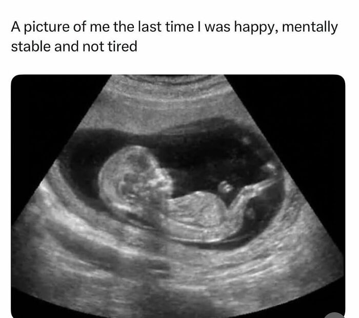 Black and white ultrasound image humorously described in a creepy but funny meme about mental stability.