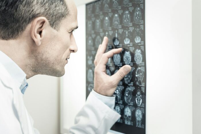 Man in a white lab coat examining brain scans, representing the complex nature of unsolved mysteries baffling people worldwide.