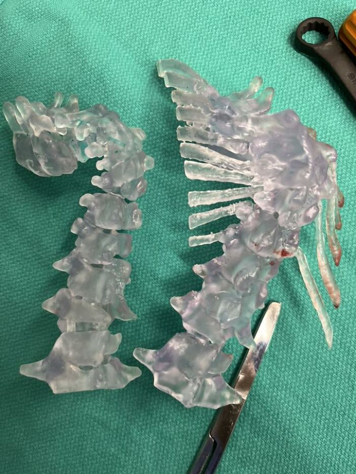 Clear 3D printed spine models on a green cloth with surgical scissors, showcasing detailed medical design any man would be excited to see.