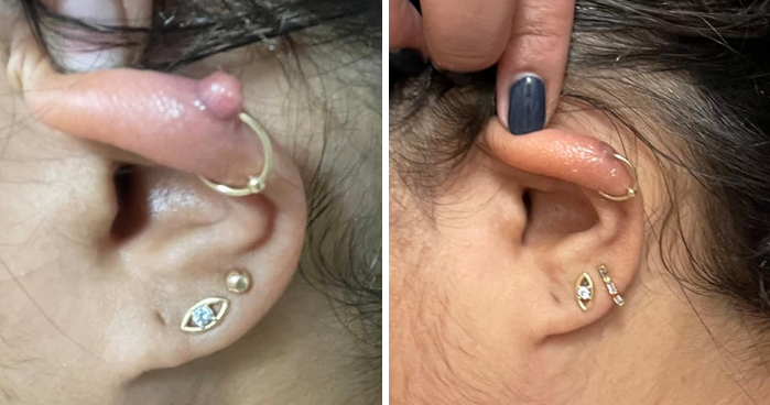 19 Gross-But-Genius Products That People Actually Swear By For Their Body Issues