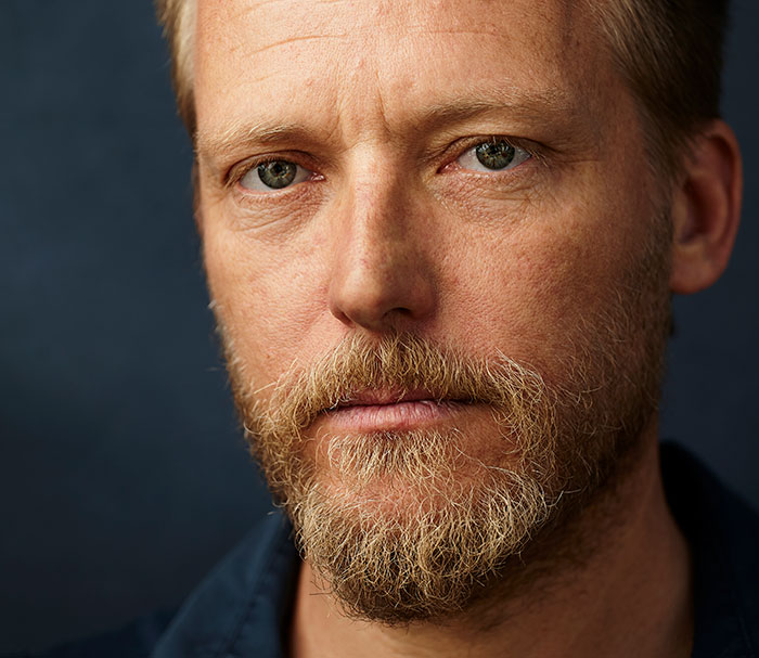 Close-up of a man’s face showing unique facial features highlighting surprising body quirks in natural light against a dark background.