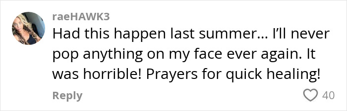 Mom Ends Up in Urgent Care After Popping Pimple In The “Triangle Of Death”