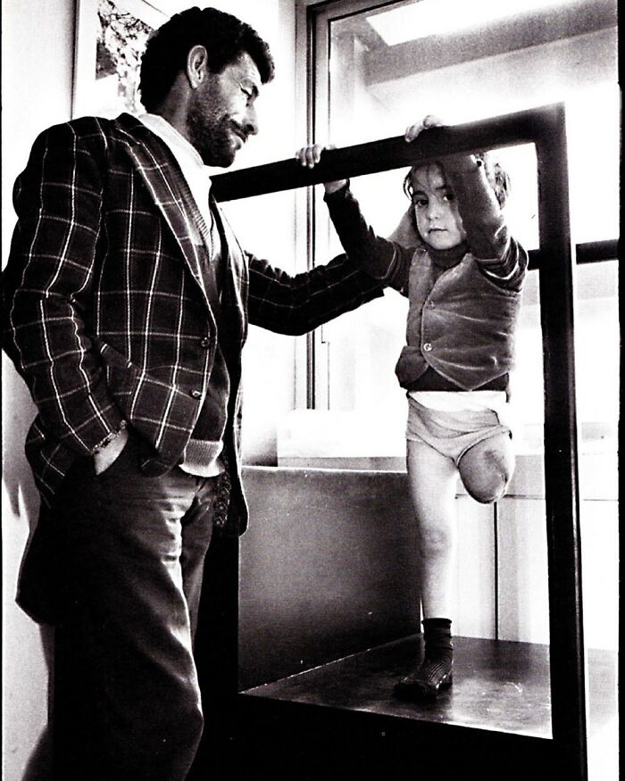 Black and white photo of a man interacting with a leg-amputee child inside a framed structure, highlighting weird history moments.