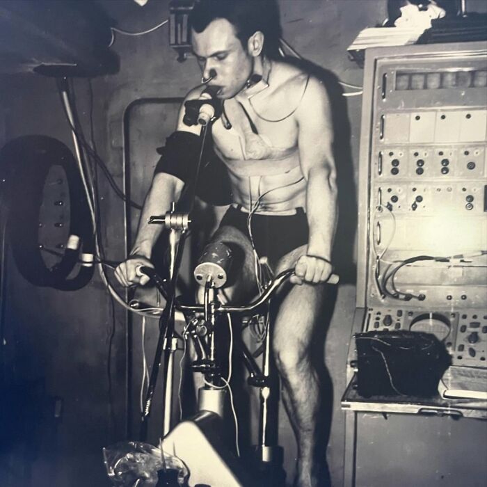 Man undergoing a medical test on a stationary bike with monitoring equipment in a weird history pic revealing past technology.