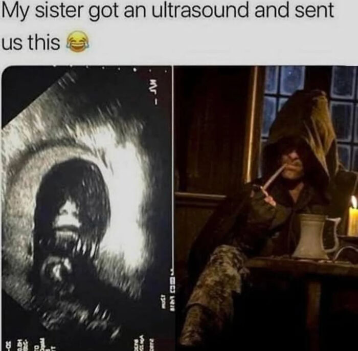 Ultrasound image resembling a hooded character smoking a pipe, part of hilarious Lord of the Rings memes collection.