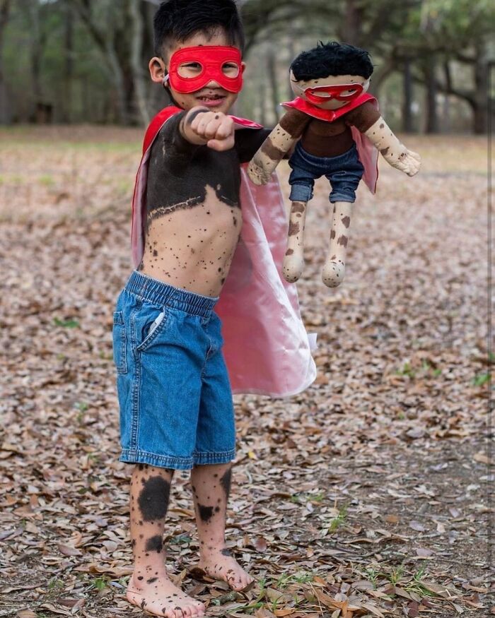 Young boy with rare health condition wearing superhero costume holding a matching doll representing his needs.