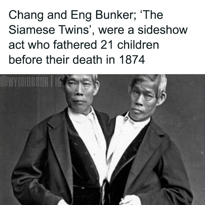Black and white photo of the conjoined Bunker twins, a random creepy fact from history to deprive somebody of sleep.
