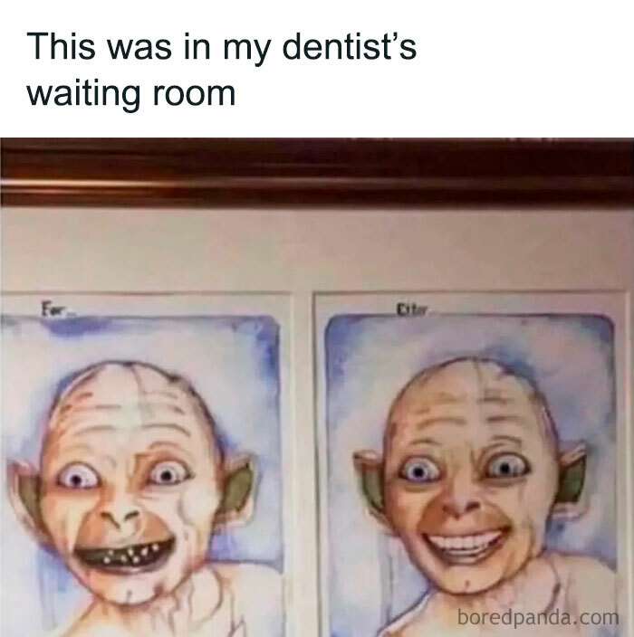 Funny Lord of the Rings meme showing a CGI character before and after dental treatment in a dentist's waiting room.